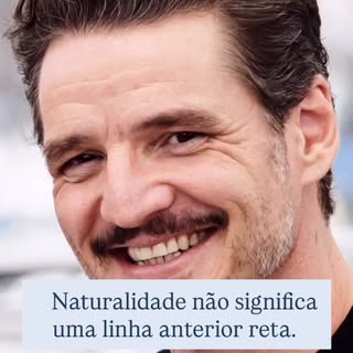 Um dos maiores erros no transplante capilar é acreditar que uma linha perfeitamente reta representa 
