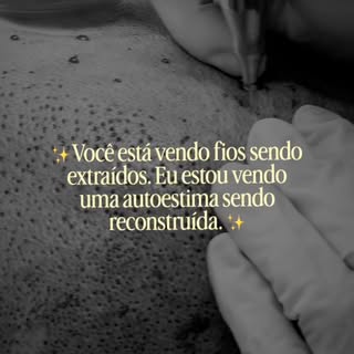 Você já pensou em quanta insegurança a calvície pode causar?

Por trás de cada transplante existe um