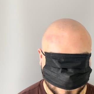 Some people start to lose their hair in their early 20’s. 

It can take a huge bash to your confiden