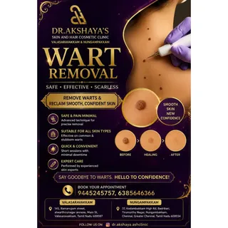 ✨ Say Goodbye to Warts – Safe & Effective Removal! ✨

Warts are common skin growths that can affect 