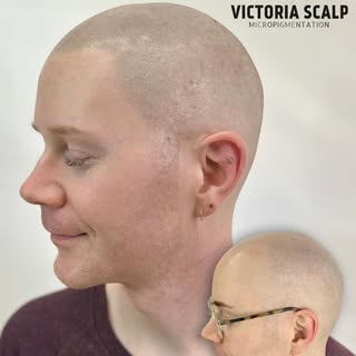CROWN TO HAIRLINE - FINAL RESULT
👉🏼👉🏼👉🏼SWIPE to see larger images

I had the honour of working