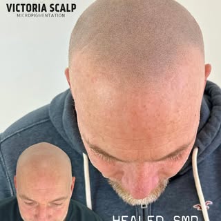 HEALED SMP • 1 YEAR OLD 
👉🏼👉🏼👉🏼SWIPE to see larger images

This client never made it for his c