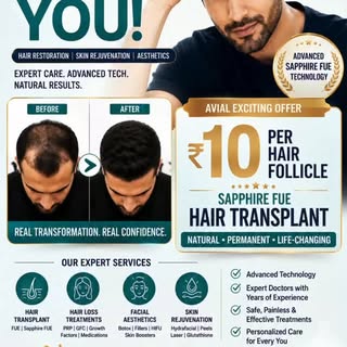 Natural density, precision, and quick recovery.

"Restore your natural density and hairline with Sap