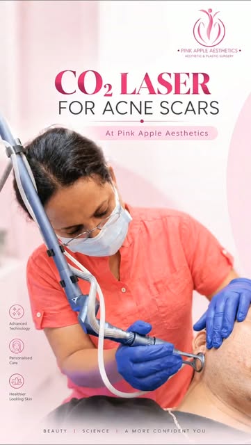 Acne scars affecting your confidence? ✨

Explore CO₂ Laser treatment for acne scars in Bangalore at 