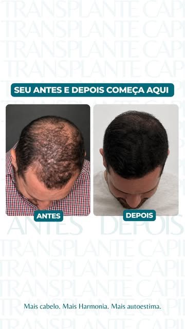 Eu tenho certeza que você também quer se sentir como esse paciente! 👇🏼

Há 1 ano e meio, o Rafael 