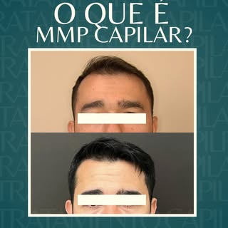 Seu cabelo não precisa “aceitar” a queda. Ele precisa de estratégia. 👀

O MMP Capilar é um tratamen