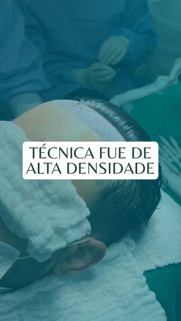 Você não precisa apenas de mais fios. Precisa de uma estratégia para que eles sejam distribuídos da 