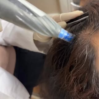 ✨Follicle activation mode: ON

Dormant follicles don’t disappear — they just need the right signals.