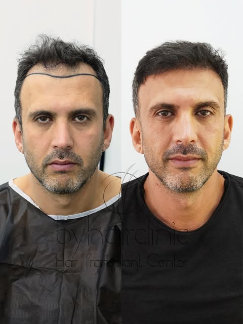 From Day 1 to Month 6 — the transformation speaks for itself.

A closer look at the different stages