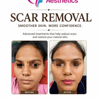 Book your consultation today!

📞 Call/WhatsApp: 99740 71055
📍Ground Floor, GLC Aesthetic, Behind H