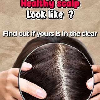 Flaking, itching, and tightness are signs your scalp needs attention. 🛑

Let our scalp and hair spe