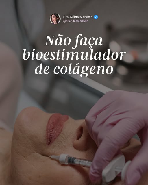 Não faça bioestimulador de colágeno… se você não quer estimular a sua pele a envelhecer melhor. 😉

