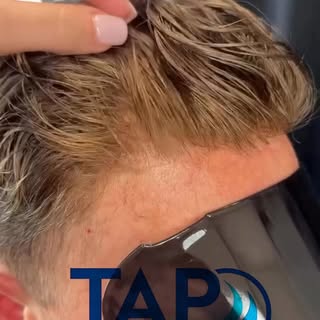 Görünmezliğin Gücü: Premium Sistem ✨  Sıradan bir saç protezi değil, bir değişim hikayesi! Tap Hair 