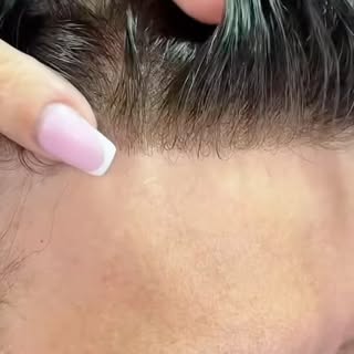 Kalite,Deneyim ve Gerçek Protez Saç…
Tap Hair olarak bu algıyı tamamen yıkıyoruz. Videoda izlediğini