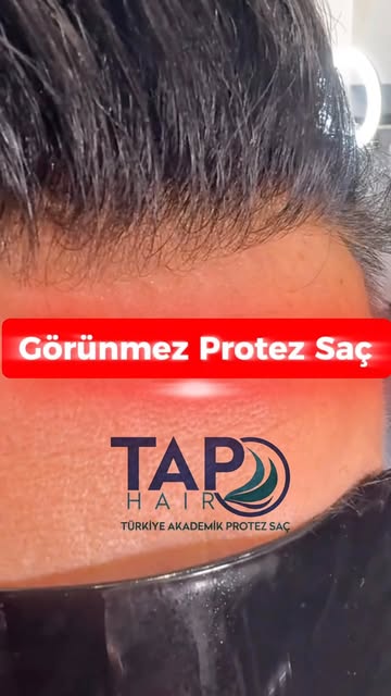 Protez saç olduğu anlaşılmıyor! Çünkü doğru sistem, doğru uygulama ve doğru işçilik fark yaratır. 🔥