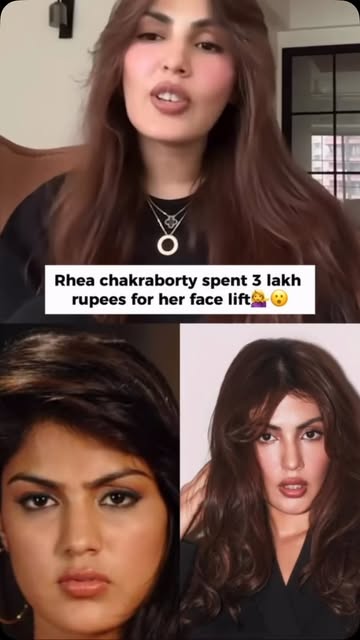Why spend lakhs when you can explore the right aesthetic options for you? ✨

From lifts and facelift
