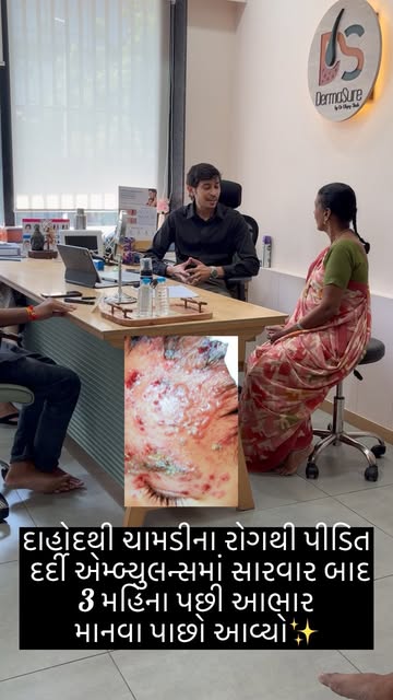 A patient came from dahod in ambulance for her skin treatment to Dr Dhyey Shah , she had severe herp