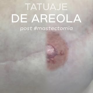 Recuperar la armonía también forma parte del proceso. 🤍

La micropigmentación oncológica con efecto