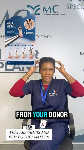 What are grafts and why do they matter? 

If you’ve ever heard us mention ‘Grafts’ and wondered what