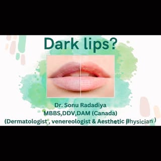 Dark lips, also known as lip hyperpigmentation, refer to a condition where the natural color of the 