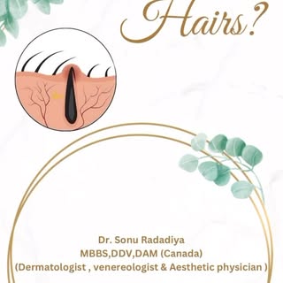 Ingrown hairs occur when a hair grows back into the skin instead of upward and outward. This conditi