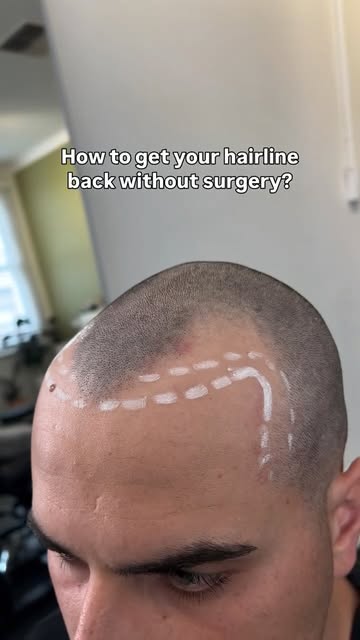 All jokes aside ..

This hairline is FLAWLESS 😩 💁🏽‍♀️✨🤌🏾

Follow us for more hairline magic @in