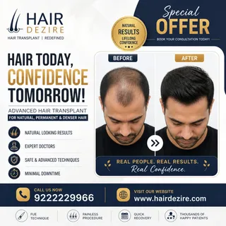 Hair transplant in mumbai