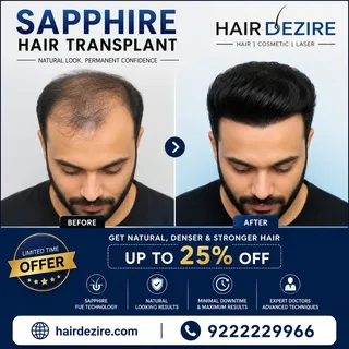 Sapphire Hair Transplant