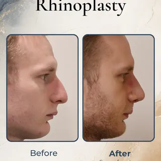 Small adjustments can have a significant effect when they are planned carefully.

In this case, the 