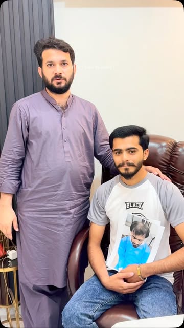 6 ماہ کا شاندار ہیئر ٹرانسپلانٹ رزلٹ
الحمدللہ! 6 ماہ کا شاندار ہیئر ٹرانسپلانٹ رزلٹ ✨

اس کلائنٹ کا 