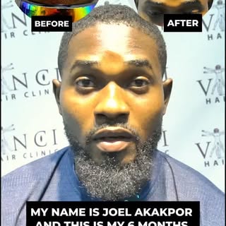 Another amazing result - just 6 months in.

Meet Joel. He walked in with questions and walked out wi