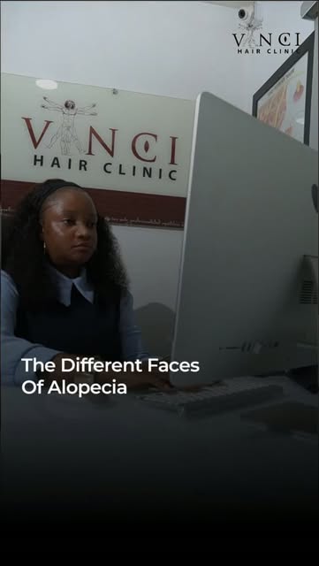 Alopecia doesn’t always look the same. 

From bald patches to hair thinning or complete hair loss, A