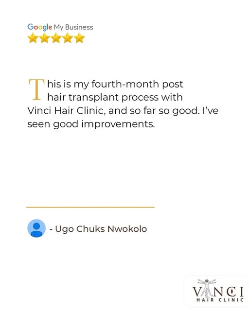 We’re always glad to hear how our clients experience their Hair Restoration journey. Thank you for c