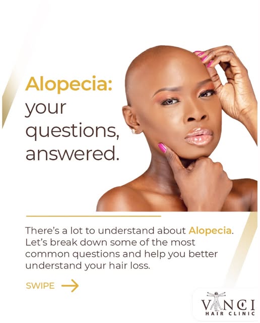 Got questions about Alopecia? 
Let’s clear a few things up.

There’s a lot of information and misinf