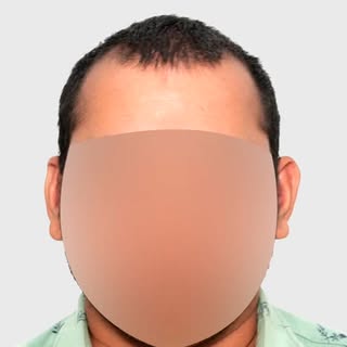 Wait till the end result!
.
.
.
See the stunning transformation and hear our client’s glowing review