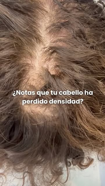 ¿NOTAS QUE TU CABELLO HA PERDIDO DENSIDAD?

Si notas menos volumen o zonas con menor densidad, el pr