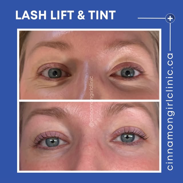 Beautiful lash lift and tint a great alternative to a more natural look. 
Call the clinic to book. 
