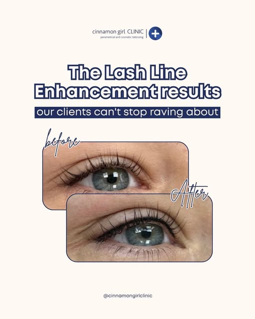 A little line. A BIG difference. 👀✨

This Lash Line Enhancement photo dump is the perfect example o
