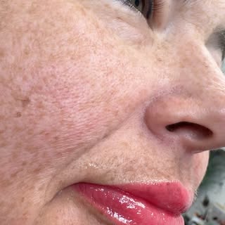 Swipe to see HEALED LIPS COLOR btw notice the 2 year old healed eyeliner 👏🏼
