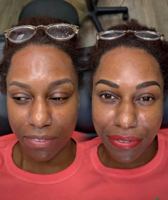 The goal with this lip neutralization was simple: get the top lip to match the natural pink tone in 