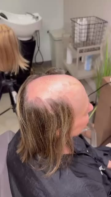Another fantastic microline transformation by @laurent_berquet using our @hairdreams_uk microline wi