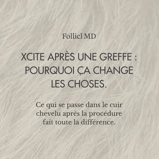 Xcite après une greffe : pourquoi ça change les choses.

Une greffe de cheveux, c'est une interventi