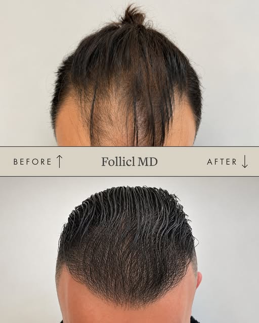 Chaque transformation raconte une histoire différente. Merci à notre patient pour sa confiance. Les 