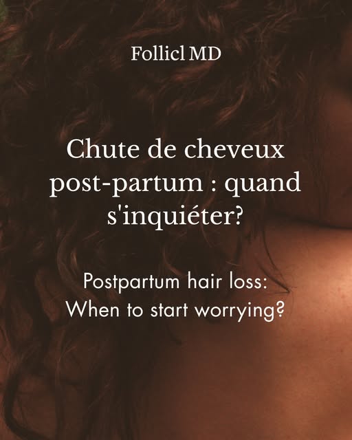 La chute de cheveux post-partum est fréquente — mais à partir de quand faut-il s'inquiéter? Chez la 