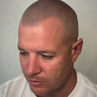 What if I told you this man is completely bald would you believe me?…