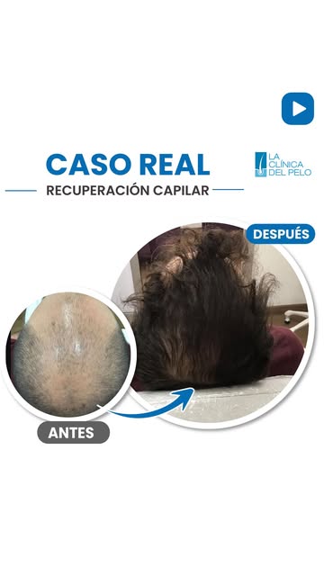 ✨ Una evolución sorprendente. El proceso continúa.

Una de las preguntas más frecuentes de nuestros 