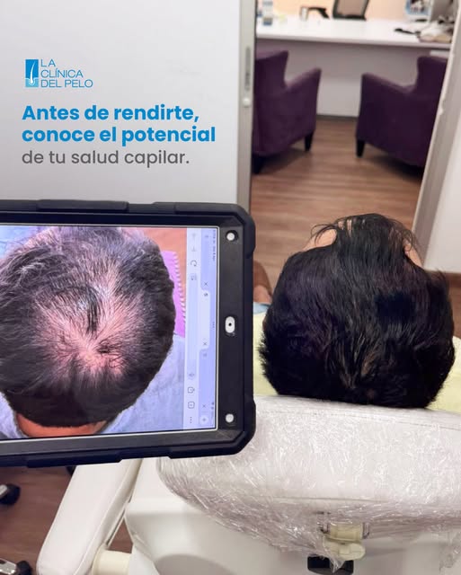 🧬 La pérdida capilar no siempre es el final de la historia.

Tu cabello merece una evaluación espec