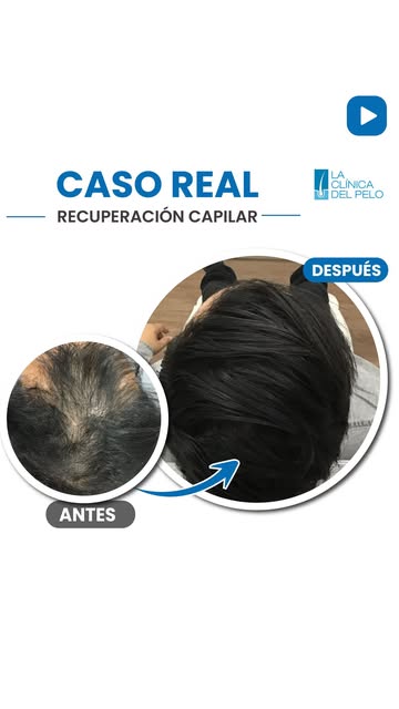 🧬 Resultados que hablan por sí solos.

Cada proceso capilar tiene su propio camino. La constancia, 