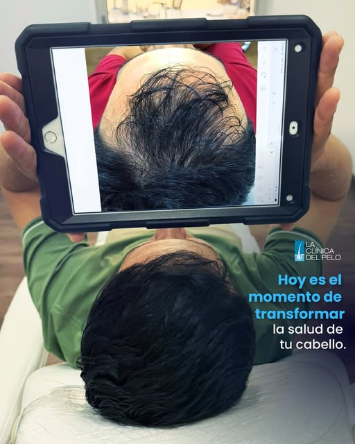 Date la oportunidad de entender qué está pasando con tu cabello.

Los cambios capilares no siempre d