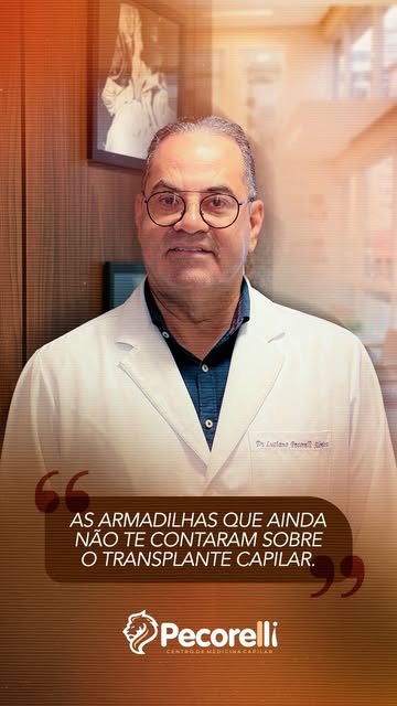 As armadilhas que ainda não te contaram sobre o transplante capilar. 👀

O transplante capilar vai m